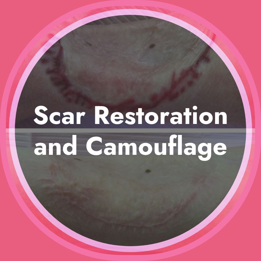 Scar Restoration and Camouflage