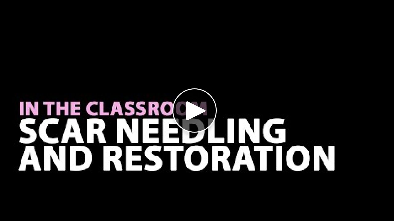 Video: Scar Needling and Restoration
